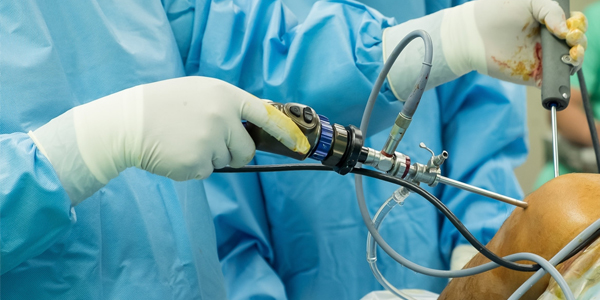 Arthroscopic Instruments