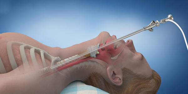Bronchoscopy Instruments
