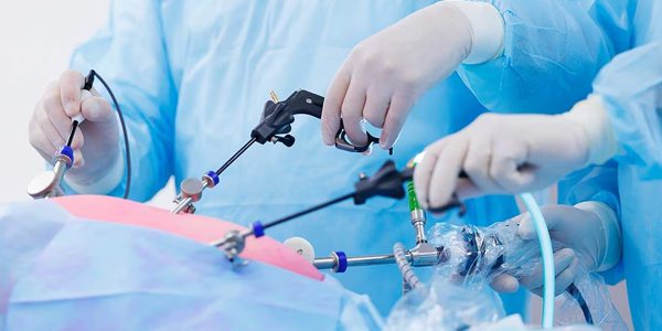 Laparoscopic Surgery Instruments